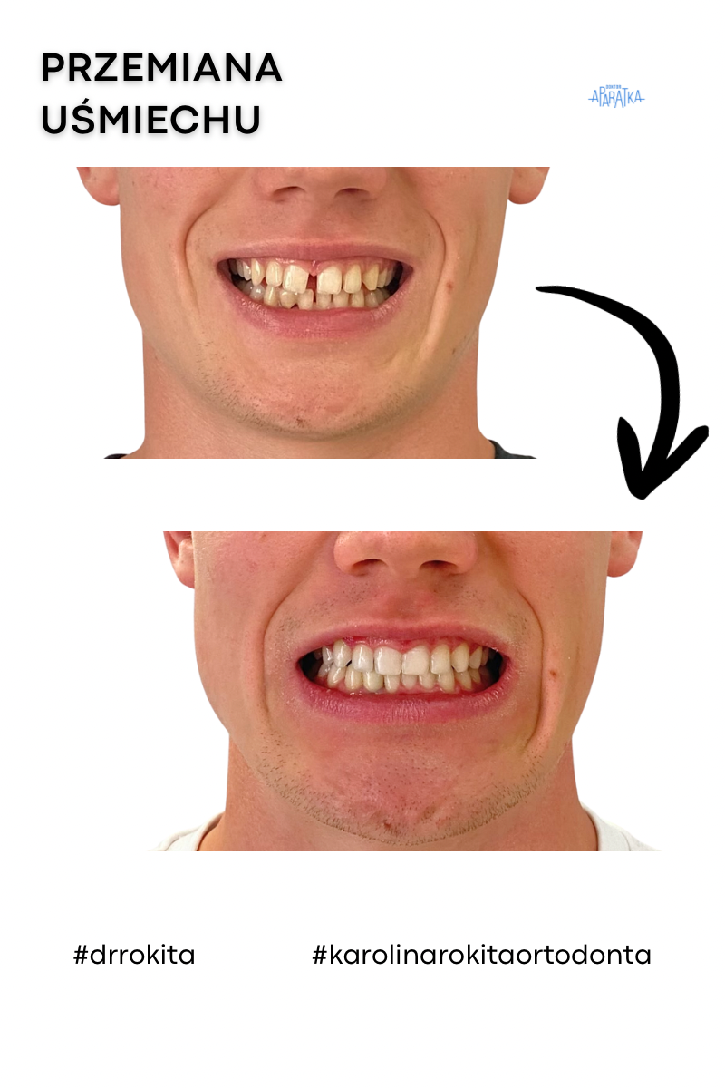 Karolina Rokita ortodonta Kielce
